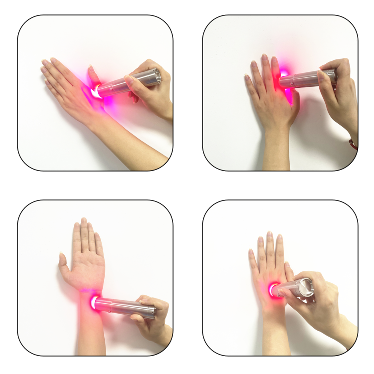 Home Facial Device Skincare Wa - Skincare You review and price