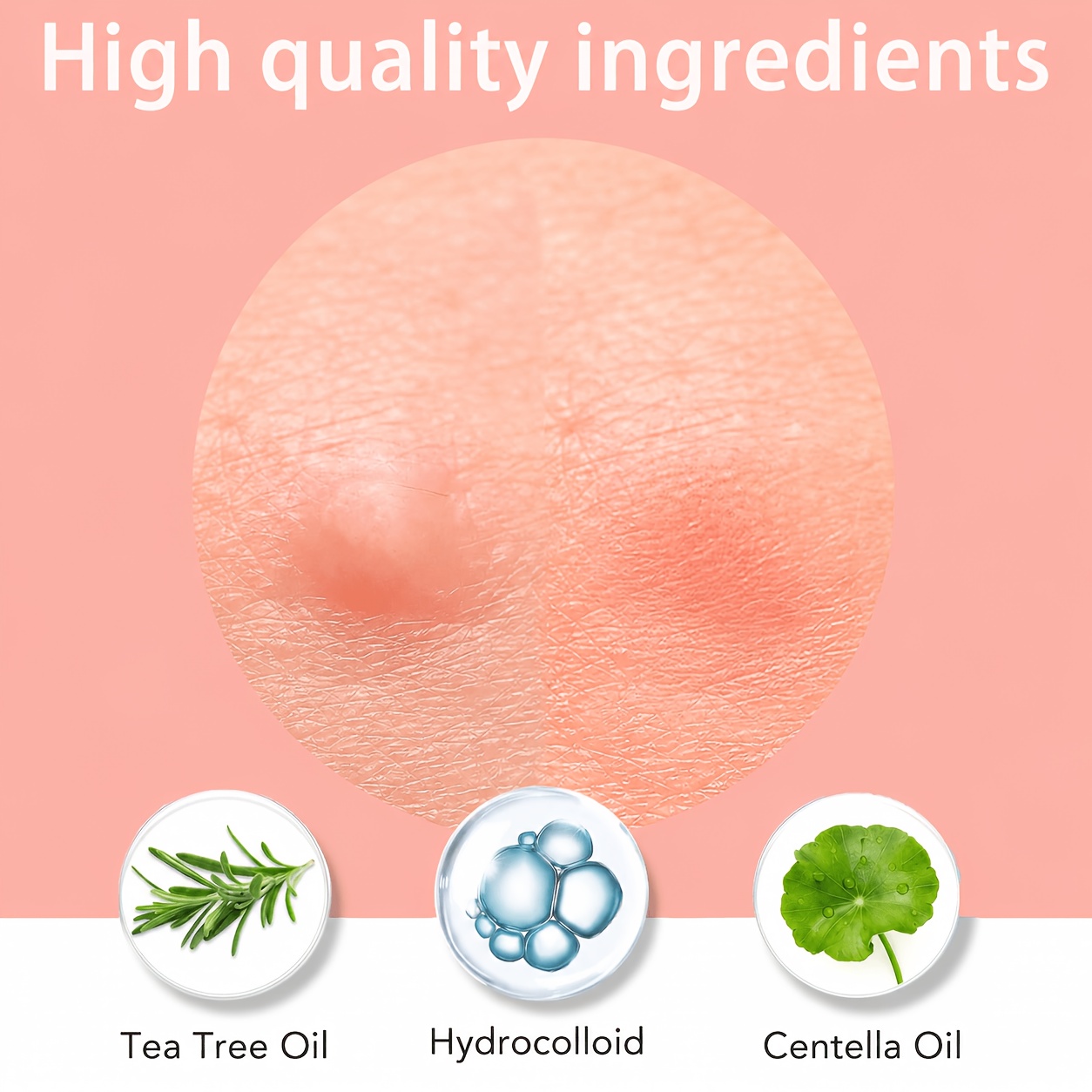 1200/400pcs/box invisible acne - Skincare You review and price